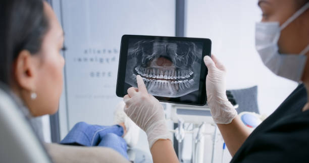 Licensed Wisdom Tooth Removal service in Campbell, CA - Smile Center Dentistry